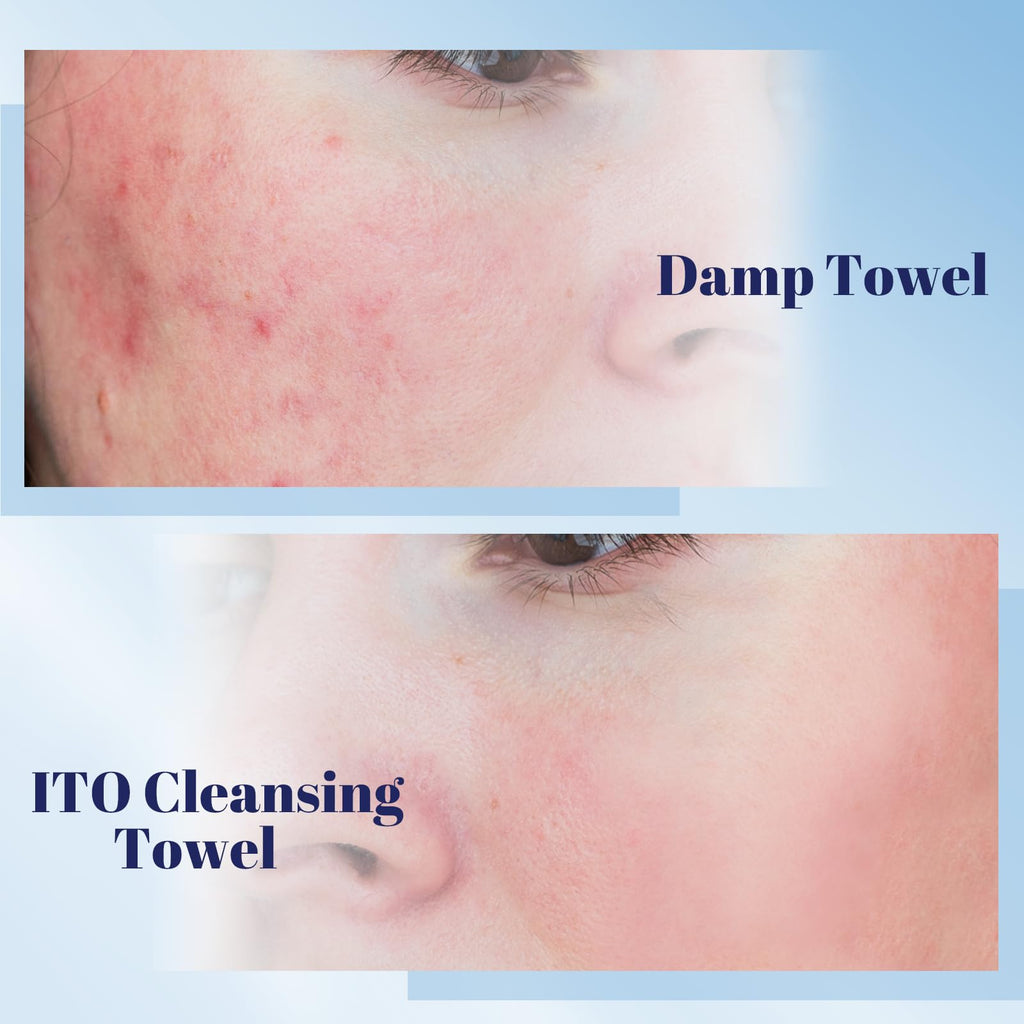 ITO Face Towels, Ultra-Soft & Extra Thick Cleansing Towels for Sensitive, Dry & Oily Skin, Facial Tissue, Makeup Remover Disposable Towels (70 Count (Pack of 1))