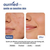 Ourmed Life Disposable Face Towels, XL, Ultra Soft & Absorbent, 50 Count