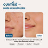 Ourmed Life Disposable Face Towels XL, Ultra Soft & Absorbent, 150 Count | 10" x 12", Sensitive Skin Friendly, Skin Soothing, Redness Care, Biodegradable, Facial Towels for Makeup Removal & Cleansing