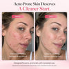 DermaClear™ Face Towels for Sensitive Skin, XL Disposable Face Towels