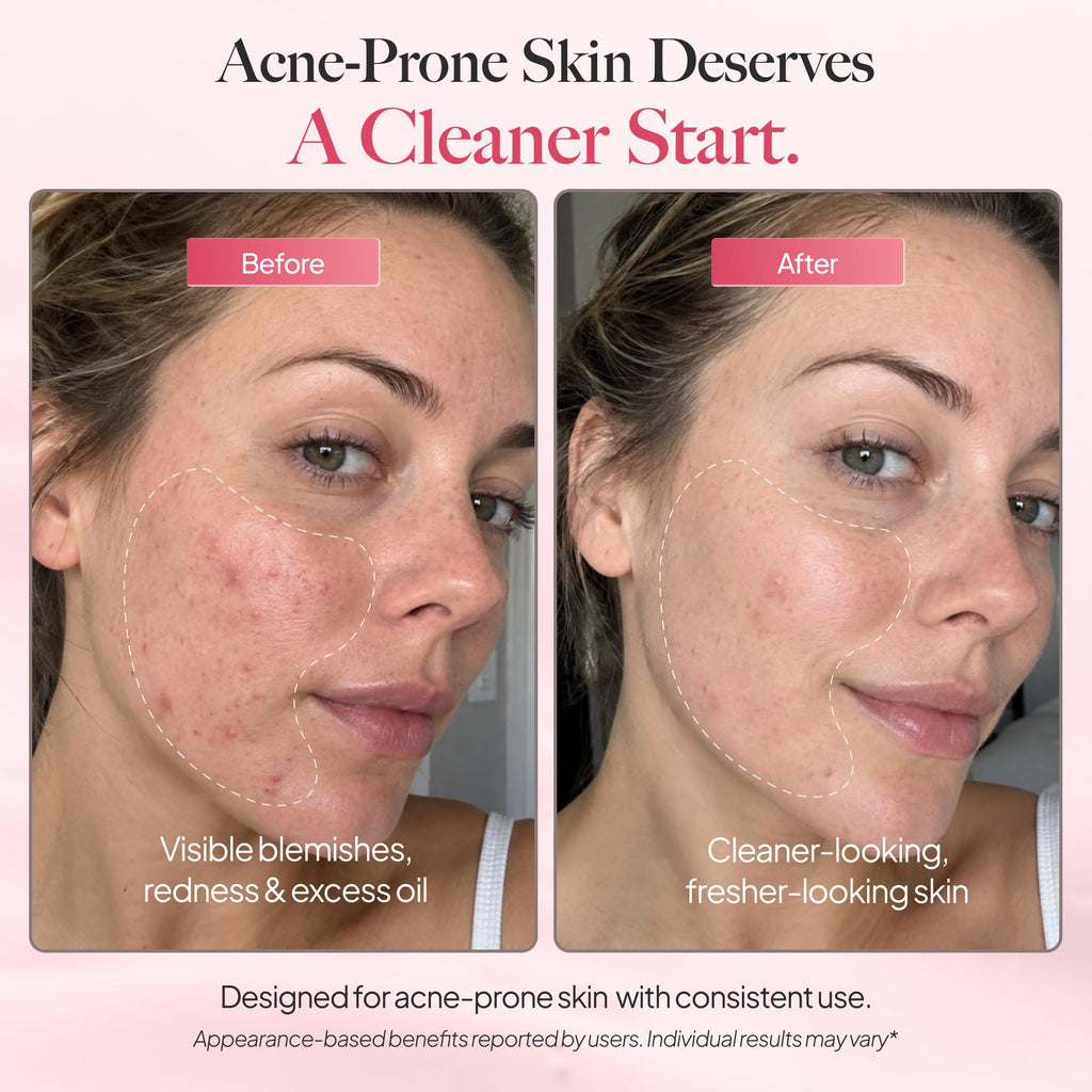 DermaClear™ Face Towels for Sensitive Skin, XL Disposable Face Towels